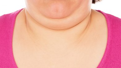 Causes Of Chin Fat: How to Get Rid of Chin Fat? Best Ways to Get Rid Of Chin Fat