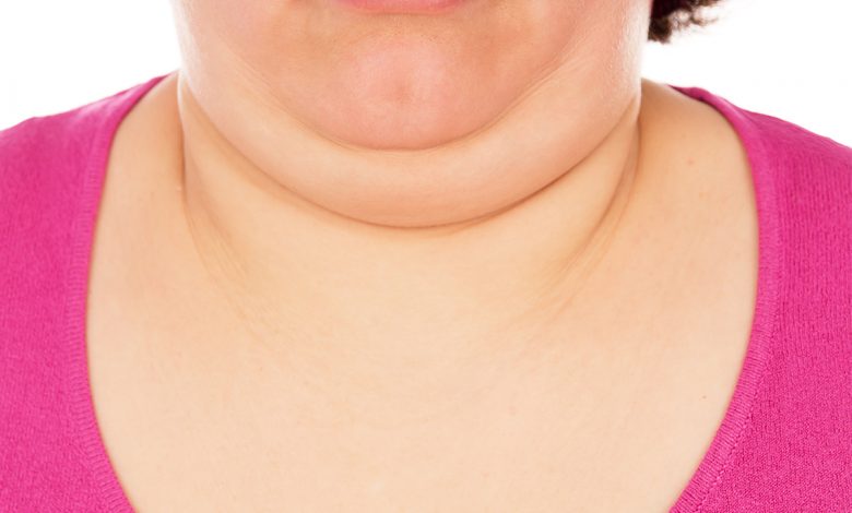 Causes Of Chin Fat: How to Get Rid of Chin Fat? Best Ways to Get Rid Of Chin Fat