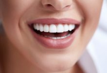 Teeth Whitening Products 