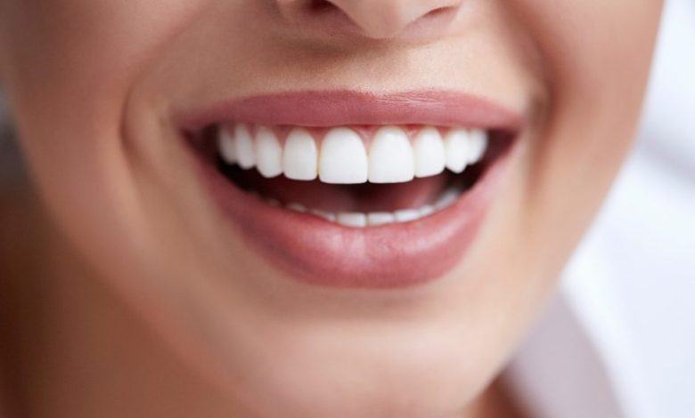 Teeth Whitening Products 